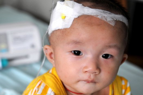 Збільшується народжуваність потворних дітей  через забруднення навколишнього середовища в Китаї