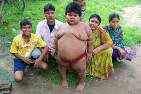 В Індії 5-річна дівчинка важить 76 кілограмів
