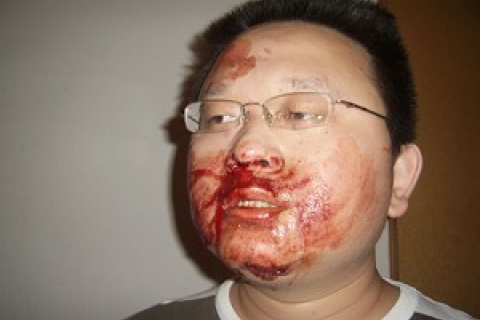 Незалежного депутата Сунь Буар побив співробітник Відділу державної безпеки Китаю