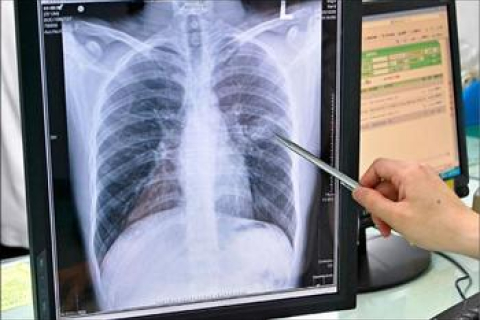 Почти половина населения Китая заражена туберкулёзом