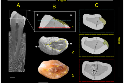 Археологи знайшли пломбу в зубі віком 6 тисяч років