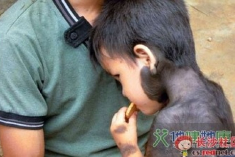 В Китае живёт «волосатый мальчик», который болезненно переносит стрижку