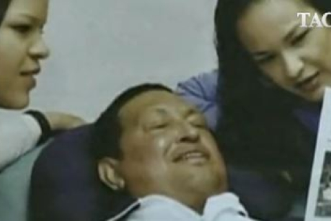 Стан здоров'я Уго Чавеса погіршився