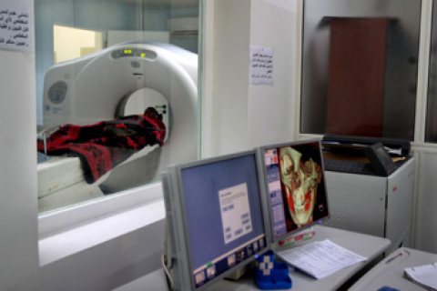 Нове дослідження: комп’ютерна томографія та ангіографія можуть викликати захворювання щитовидної залози