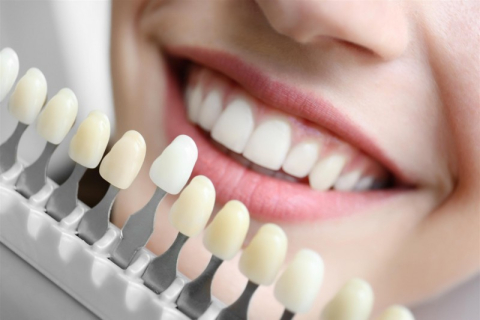 Естетична стоматологія та використання вінірів