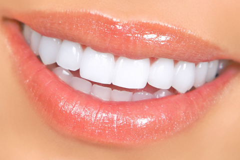 Виниры: долгий путь средства №1 в художественной реставрации зубов 