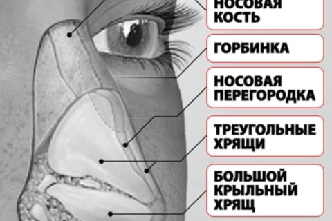 Горбинка на носу: откуда она берётся и можно ли от неё избавиться?