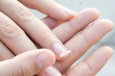 Ногти указывают на состояние здоровья. Как ухаживать за ногтями