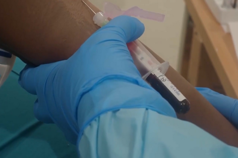 Три людини померли від вірусу Марбург в Ефіопії (ВІДЕО)