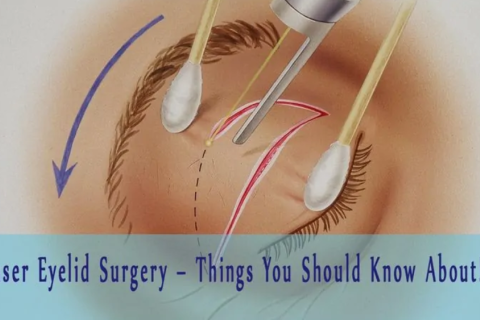 Чем хороша лазерная блефаропластика