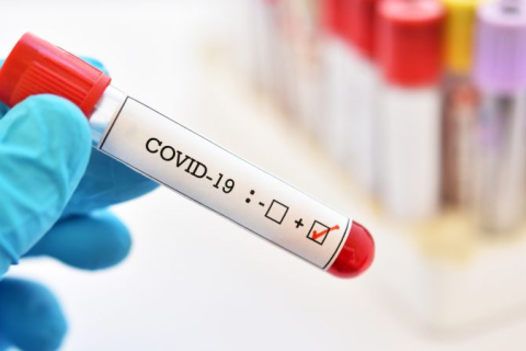 У Норвегії зі 120 вакцинованих учасників різдвяної вечірки половина заразилися на COVID-19